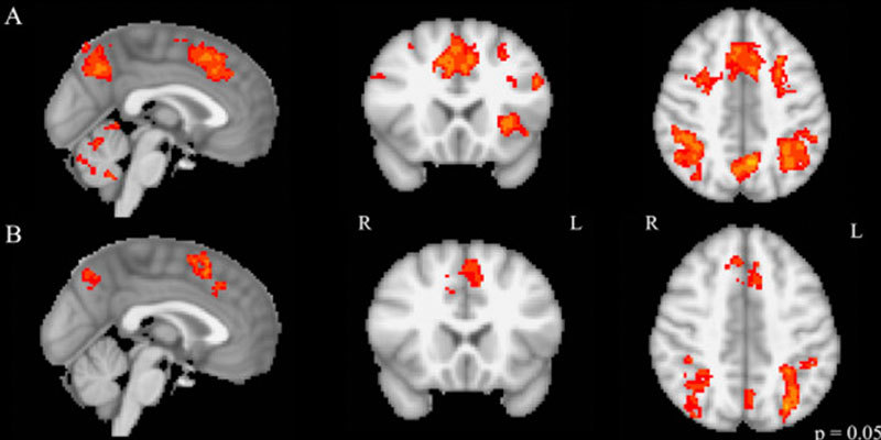 Playing an instrument is the best workout for the brain